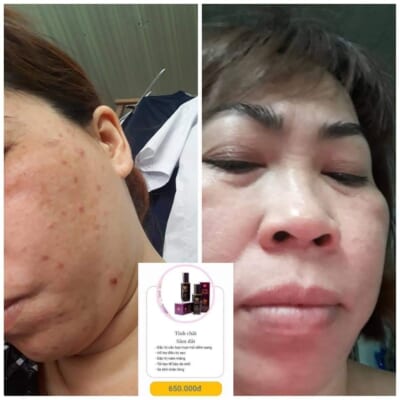 BỘ THẢO MỘC HÀN